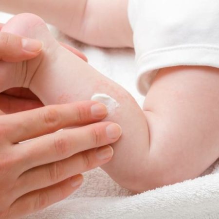 pielęgnacja skóry niemowlaka