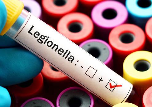 legionella