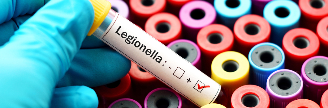 legionella