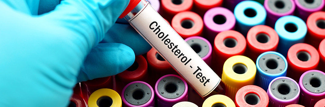 badanie na cholesterol