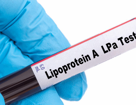 lipoproteina a