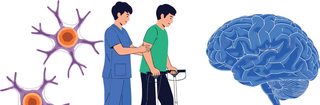 rehabilitacja po udarze mózgu