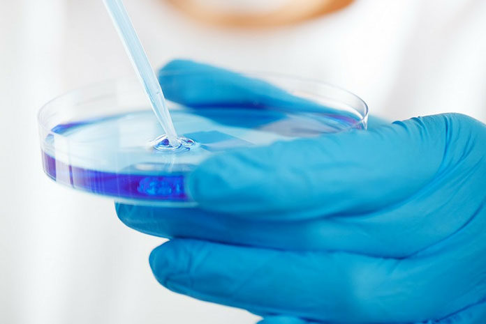 zdjęcie przedstawiające dłoń w niebieskiej gumowej rękawiczce, badającej próbkę mikrobiologiczną