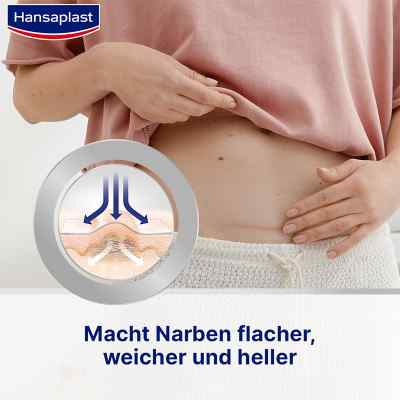 Hansaplast plastry do leczenia blizn zamów na apo-discounter.pl