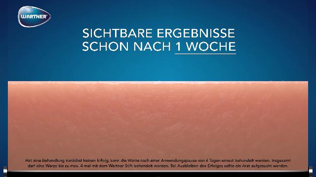 volume prostatico normale cc video